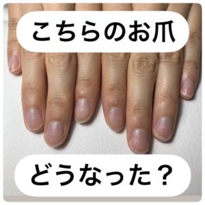 ２か月でこんなにきれいに 名古屋市東区にあるネイルサロン Megnail